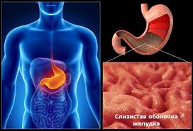 Гастрит Гастрит
